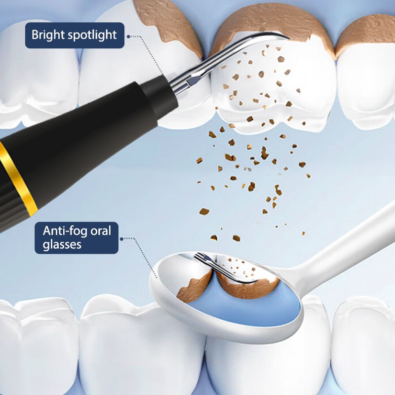 Dental Scaler Manufacturer - Portable Rechargeable LED Sonic Teeth Cleaner