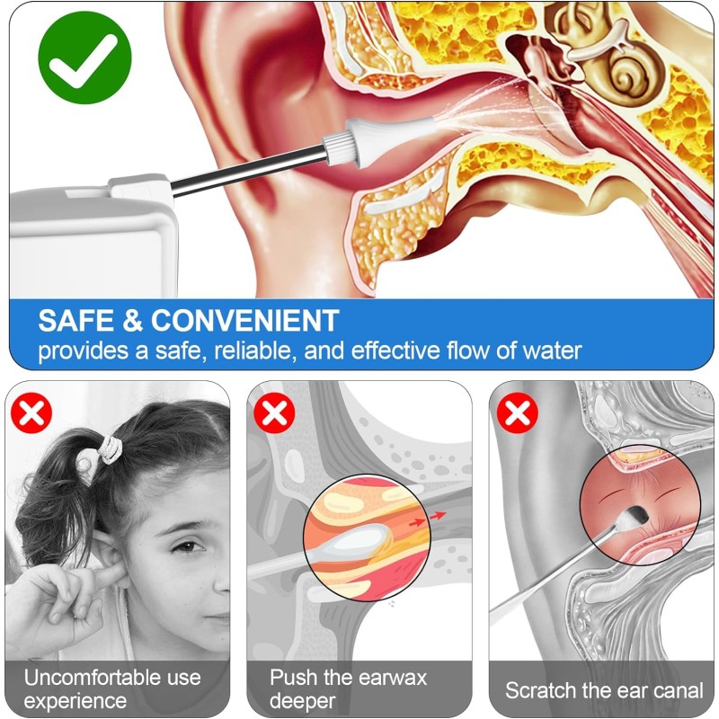 Electric Ear Cleaner Manufacturer - Household Smart Vacuum Ear Washer Earwax Removal
