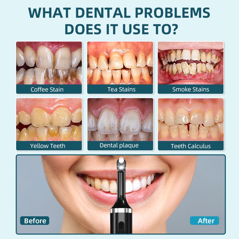 Teeth Cleaning Kit Manufacturer - Portable Multi-purpose Whitening Tool 5 Brush Heads LED