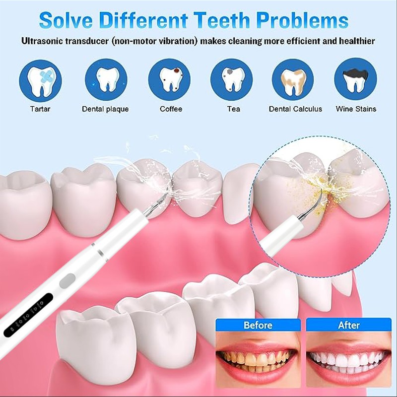 Dental Scaler Manufacturer - Popular Design High Power Plaque Remover Tartar Remover for Household