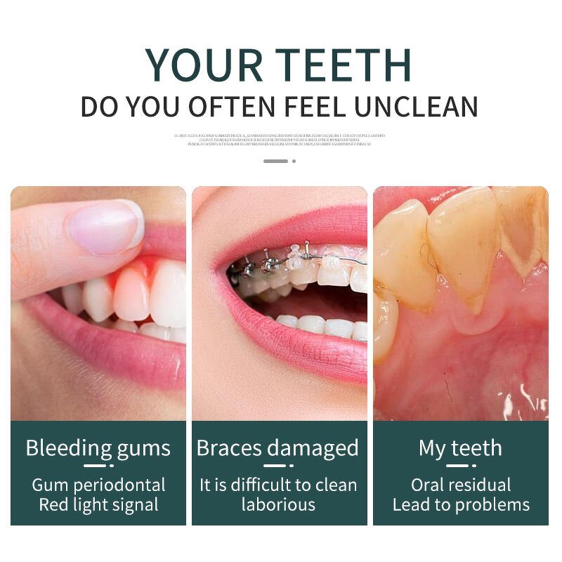 Tooth Polisher Kit Manufacturer - Dental Calculus Remover Polishing Whitener Teeth Cleaner Home