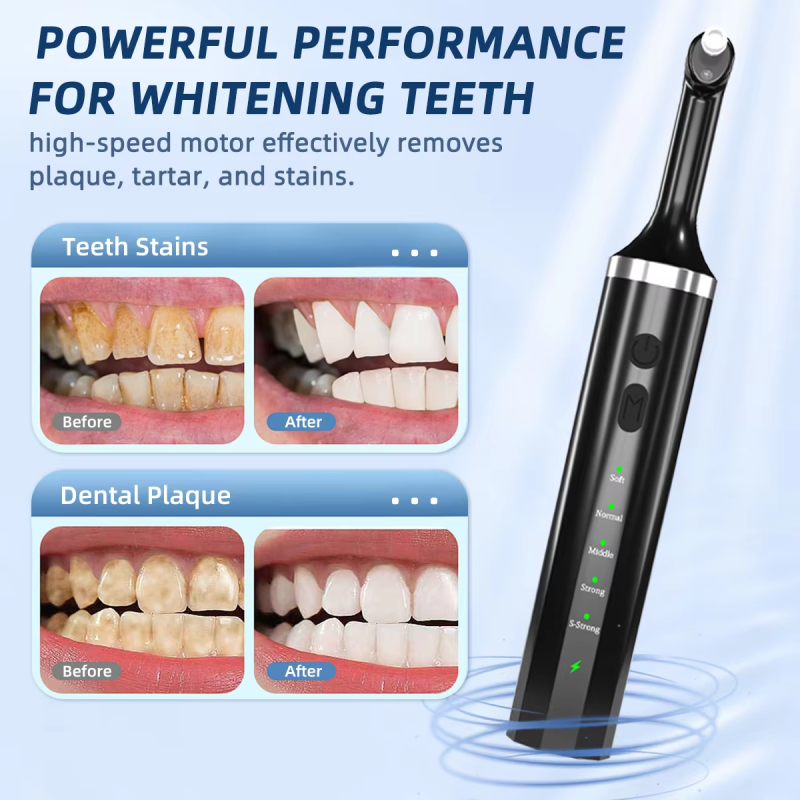 Tooth Polishing Kit Manufacturer - High Demand Rechargeable for Teeth Cleaning and Whitening