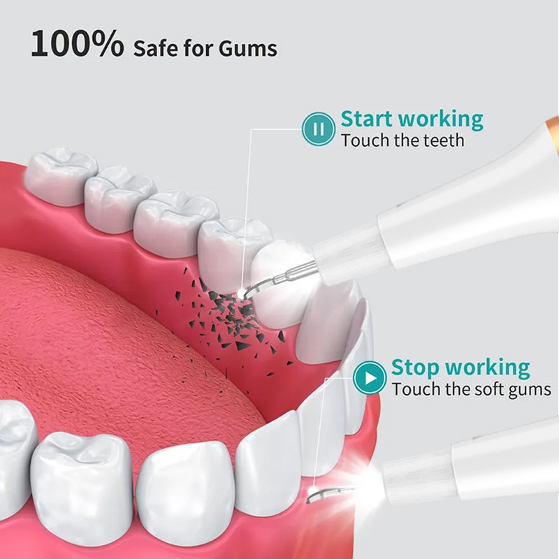 Dental Cleaning Device Manufacturer - Factory Price Professional Portable Oral Care for Household