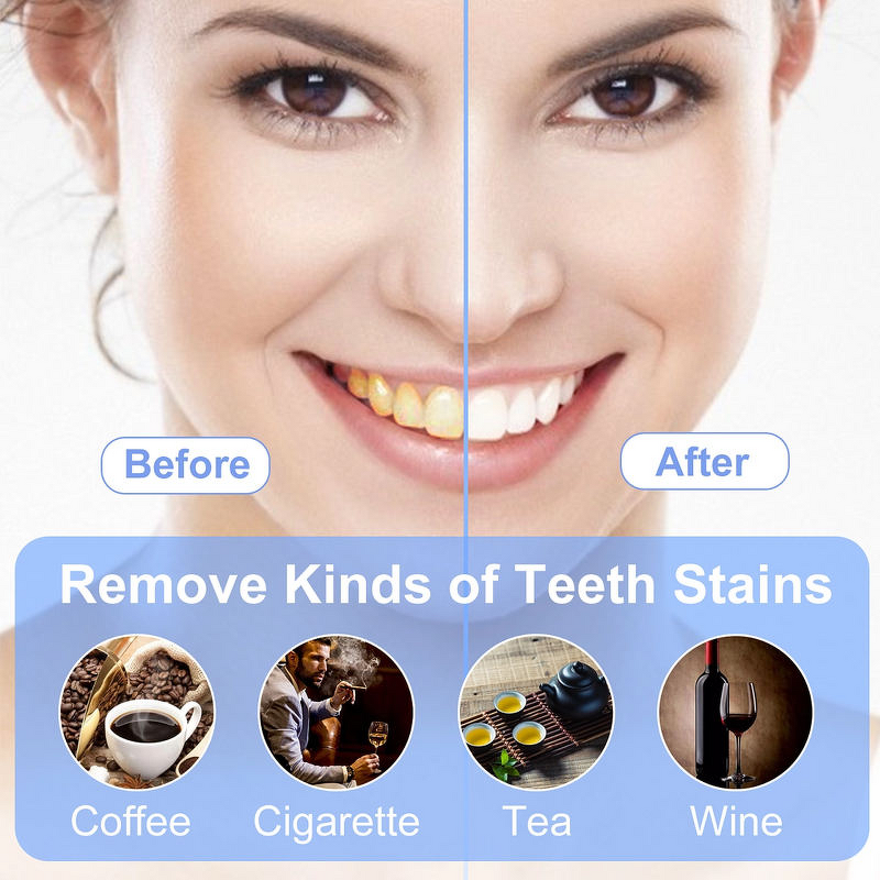 Teeth Whitening Kit Manufacturer - Professional Rechargeable Wireless with LED Light Lamp