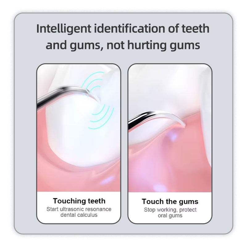 Ultrasonic Teeth Cleaner Manufacturer - Portable with Visual Camera WiFi Tartar Calculus Remover