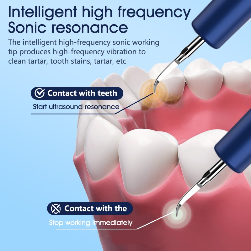 Ultrasonic Teeth Cleaner Manufacturer - Portable IPX6 Waterproof High Power Plaque Remover