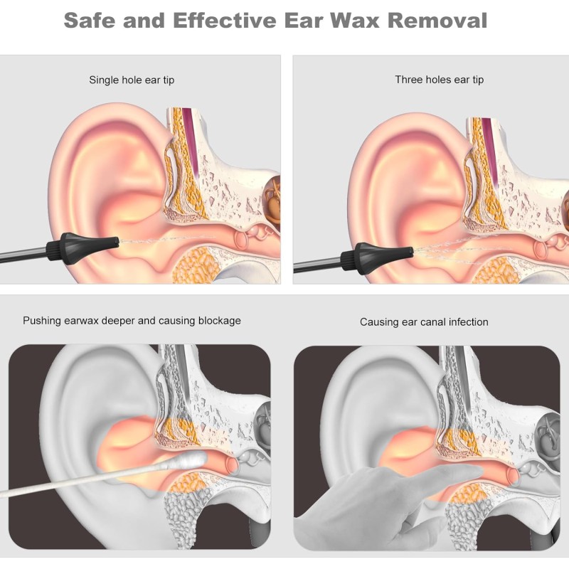 Ear Irrigation System Manufacturer - Water Powered Rechargeable Electric Flushing Wax Removal Tool