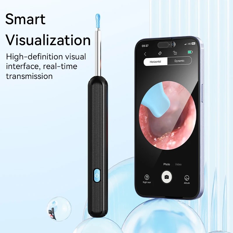 Visual Earpick Kit Manufacturer - Factory Otoscope Endoscope with WiFi for Ear Cleaning