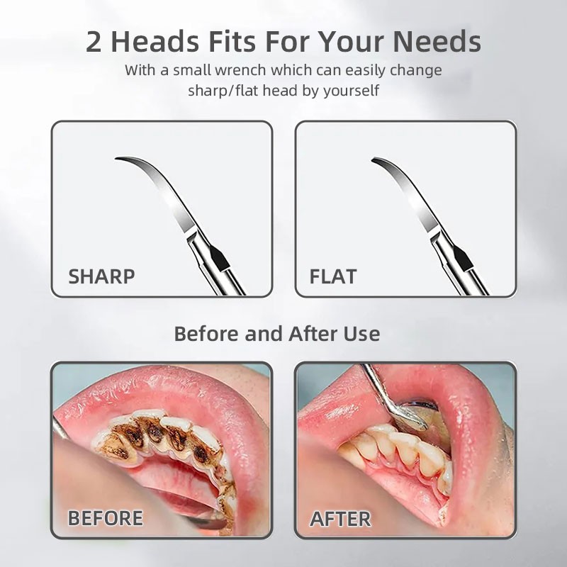 Ultrasonic Teeth Cleaner Manufacturer - Portable with Visual Camera WiFi Tartar Calculus Remover
