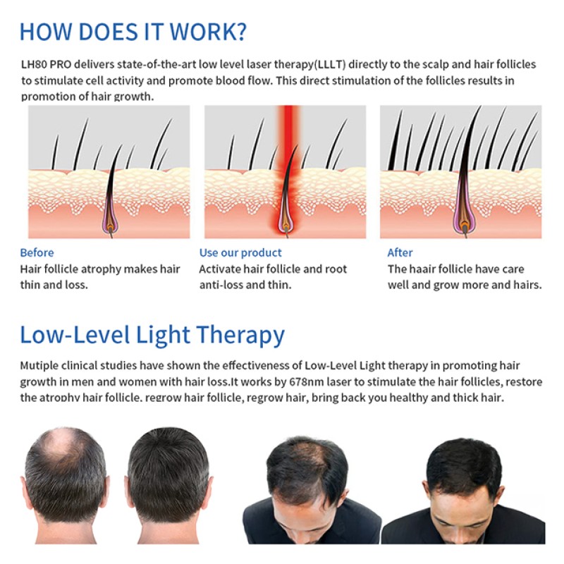 2022  650 660 670nm Red Led Light Hair Growth Therapy Helmet Hair Regrowth Helmet Device for Home Use