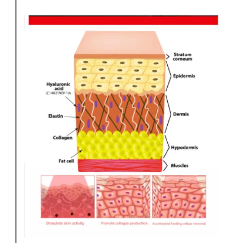 SGROW Home Use 660nm 850nm Cob Red Infrared Light Therapy