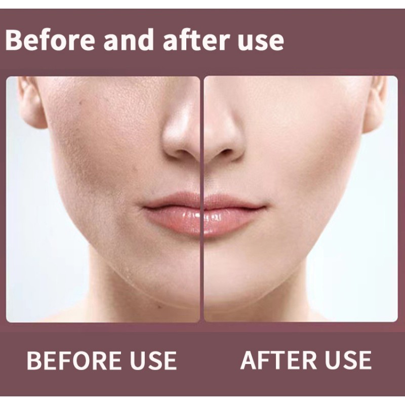 Magic Beauty Equipment Facial Lifting Electric V- Face Shaping Massager Microcurrent Face Slimming Instrument