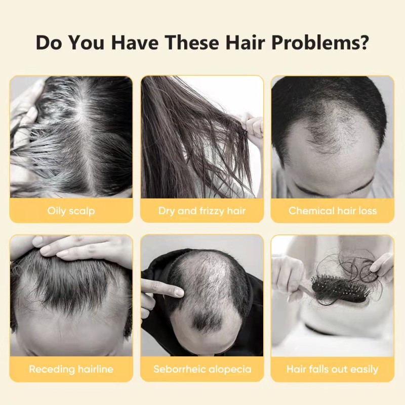 650nm Light Therapy Hair Loss Treatment Helmet Red Blue Light Led Laser Hair Growth Cap Hat for Men Women Hair  Regrowth