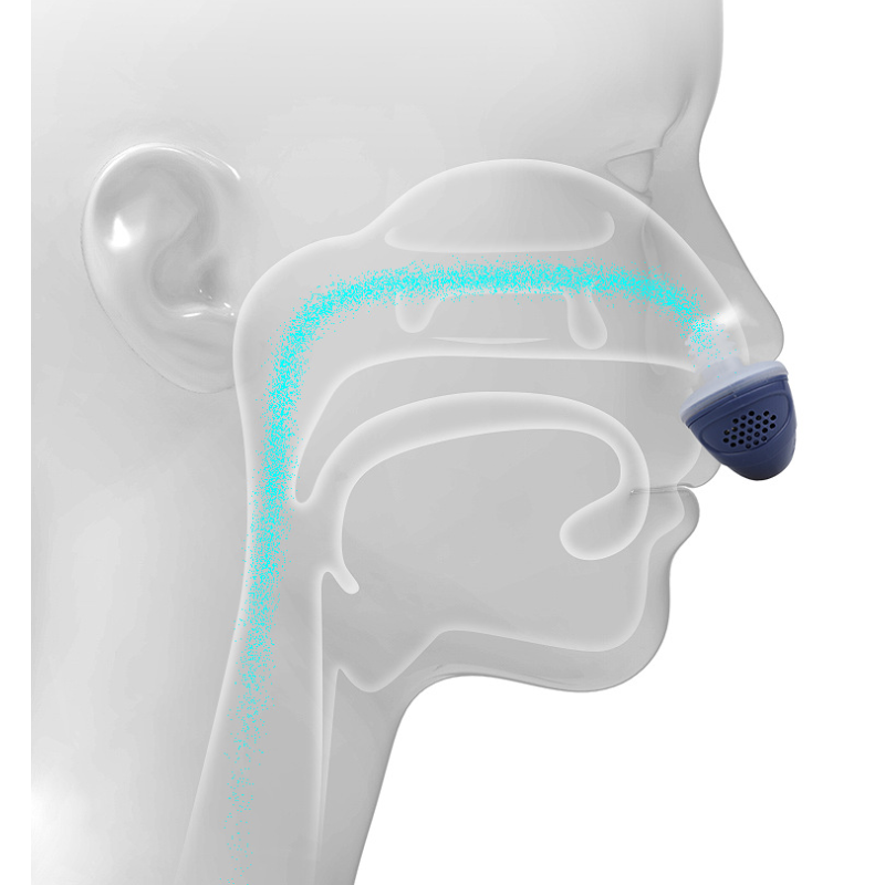 Anti Snore Device - Nose Vents Snoring Aid
