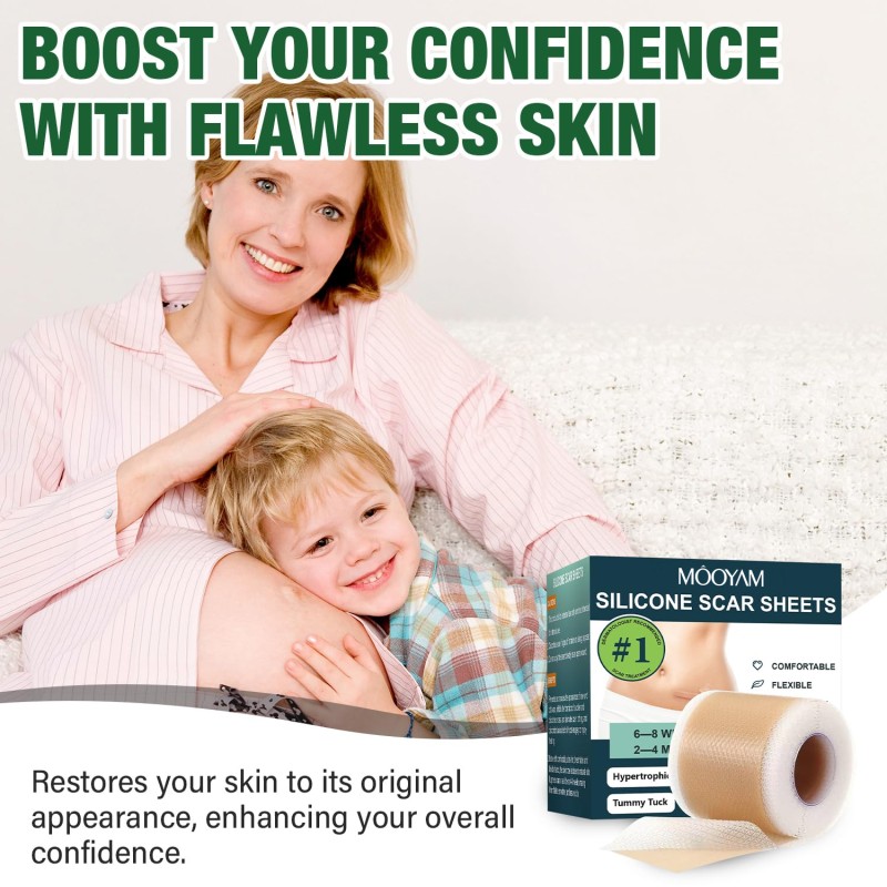 Private Label Scar Keloid Bump Removal Tape Silicone Scar Sheets for Surgical Scars (1.6"x 60" Roll-1.5M)