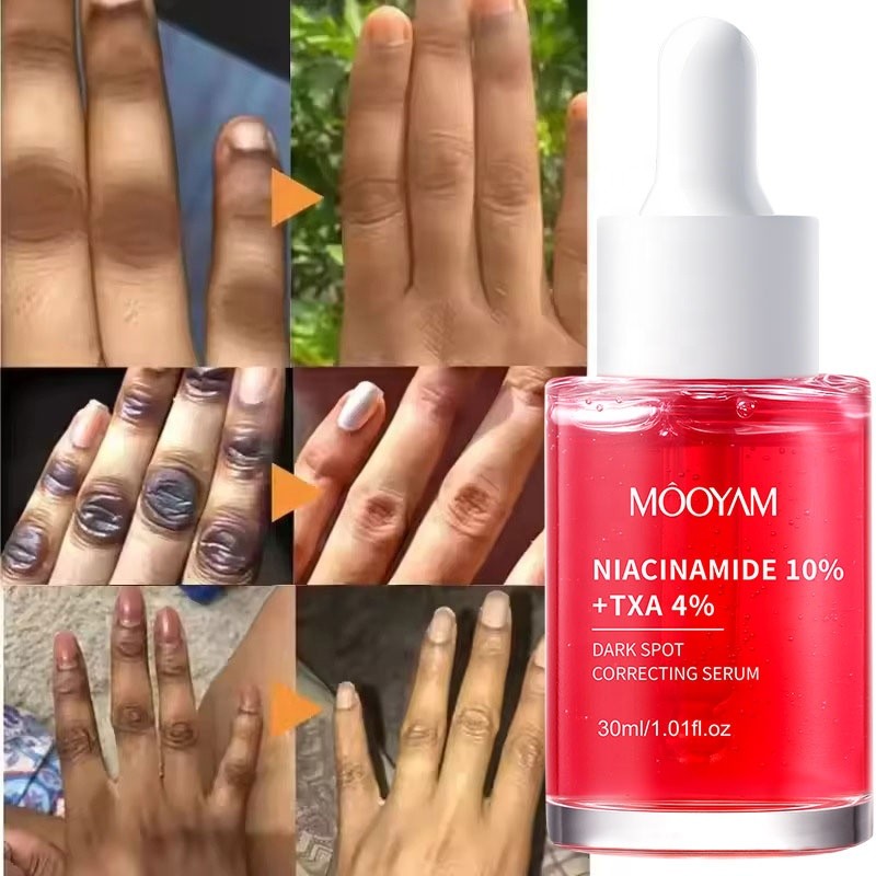 Private Label NIACINAMIDE 10%+TXA 4% Dark Spot Correcting Serum for Effective Fade Melanin