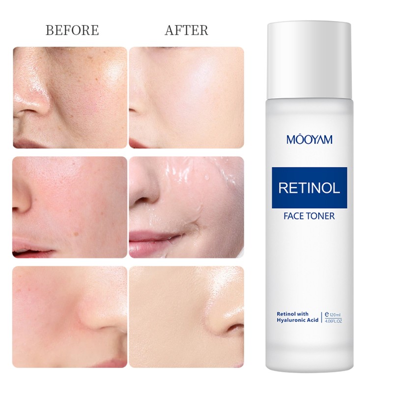 Private Label MOOYAM Face Care Products Retinol Vitamin a Toner Water Hydrating Moisturizing Antioxidant Retinol Facial Toner