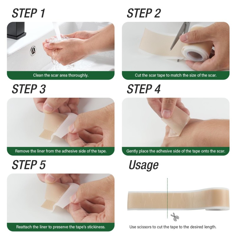 Private Label Scar Keloid Bump Removal Tape Silicone Scar Sheets for Surgical Scars (1.6"x 60" Roll-1.5M)