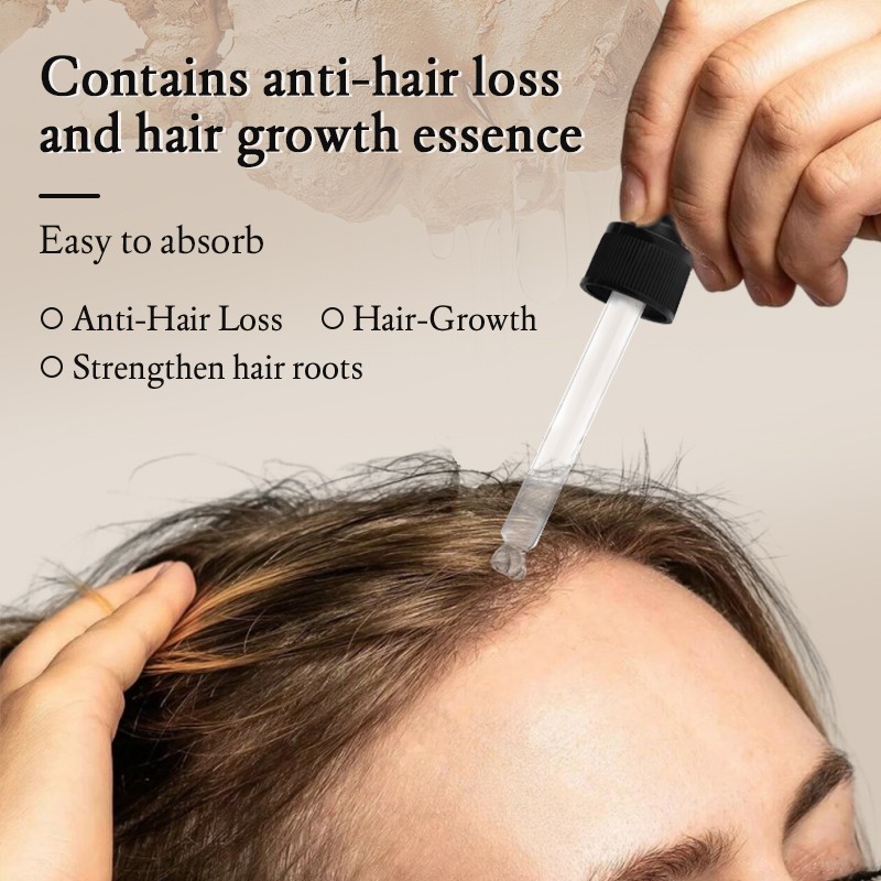 OEM Ginger Anti-hair Loss Essence Nourishing Serum Powerful Hair Moisturizing Formula Smooth 30ml MOOYAM Hair Care Growth Serum