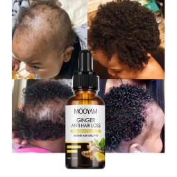 OEM Ginger Anti-hair Loss Essence Nourishing Serum Powerful Hair Moisturizing Formula Smooth 30ml MOOYAM Hair Care Growth Serum