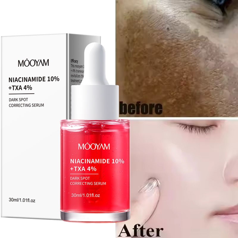 Private Label NIACINAMIDE 10%+TXA 4% Dark Spot Correcting Serum for Effective Fade Melanin
