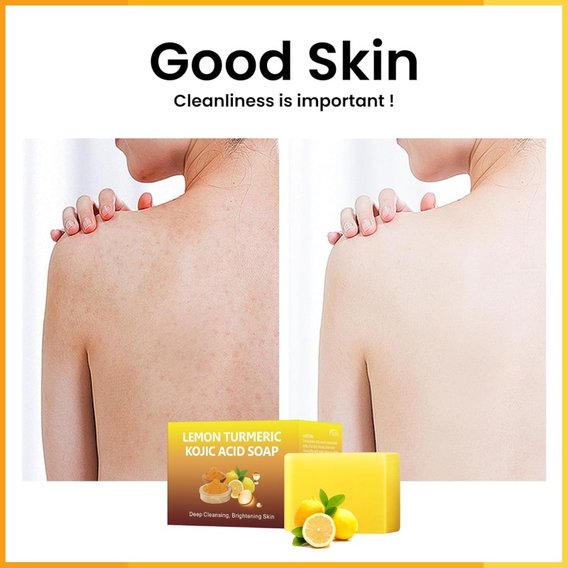 Kojic Acid Dark Spot Remover Soap Lemon Turmeric Kojic Acid Soap