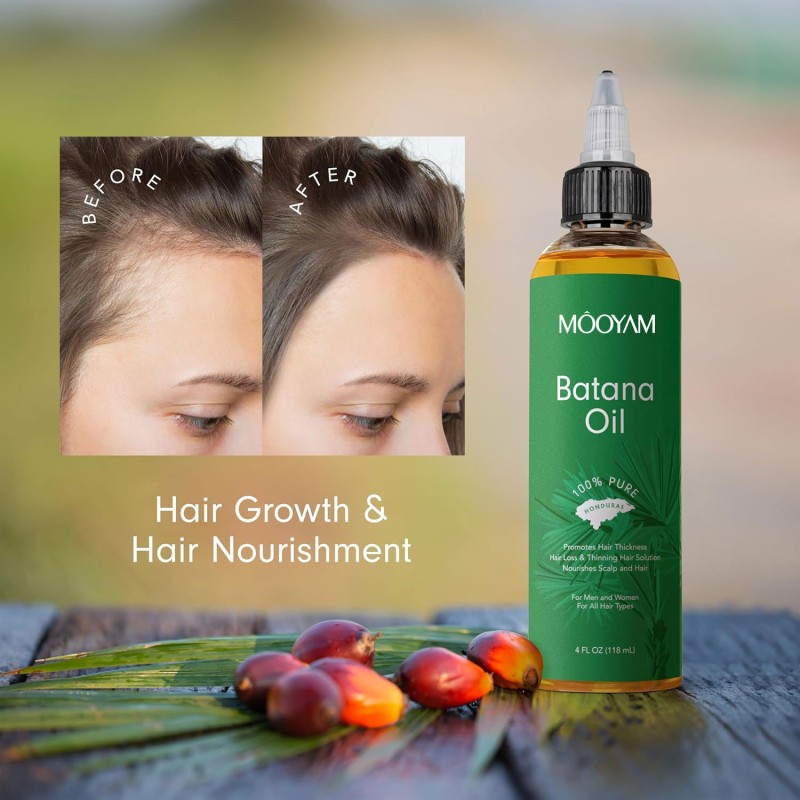 100% Pure & Natural Organic Raw Batana Oil Thicker & Stronger Hair Batana Oil for Hair Growth From Honduras