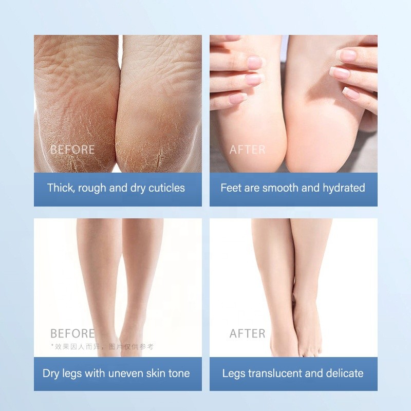 50g Foot Repair Cream Anti-Drying Foot Crack Cream Heel Chapped Repair Peeling Removal Callus Dead Skin Feet Care Cream