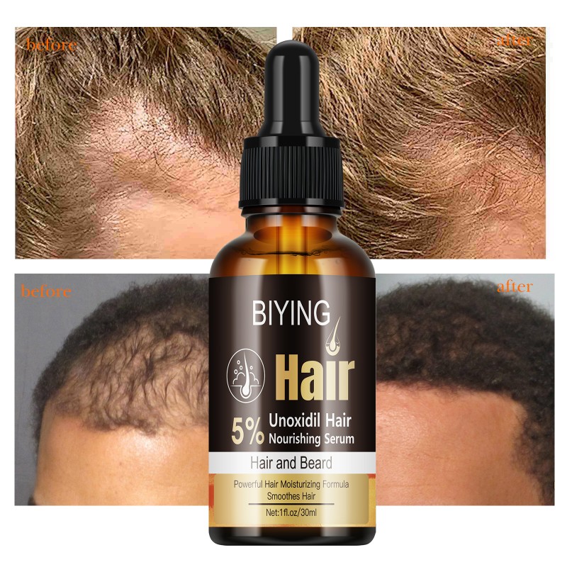 5% Unoxidil Hair Nourishing Serum Beard Nourishing Powerful Hair Moisturizing Formula Smooth 30ml MOOYAM Hair Care Growth Serum