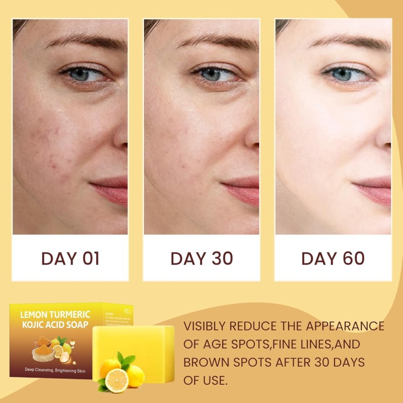 Kojic Acid Dark Spot Remover Soap Lemon Turmeric Kojic Acid Soap