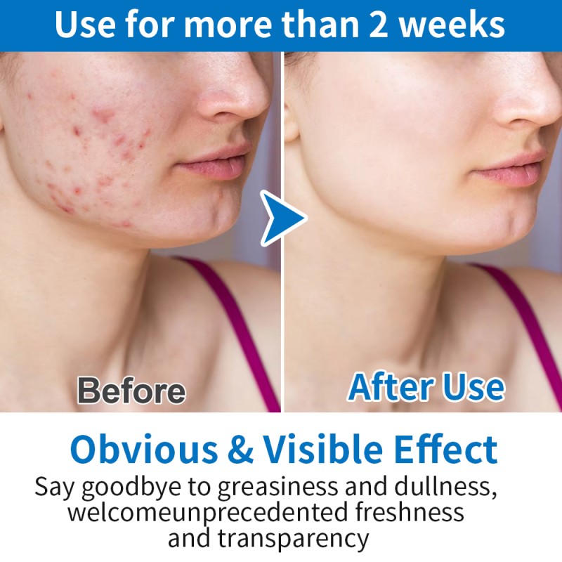 Korea Wholesale Vegan Toner Cotton Pads OEM/ODM Pore Perfecting, Improving Elasticity Soothing Moisturizing Face Toner Pads