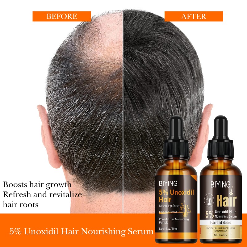 5% Unoxidil Hair Nourishing Serum Beard Nourishing Powerful Hair Moisturizing Formula Smooth 30ml MOOYAM Hair Care Growth Serum