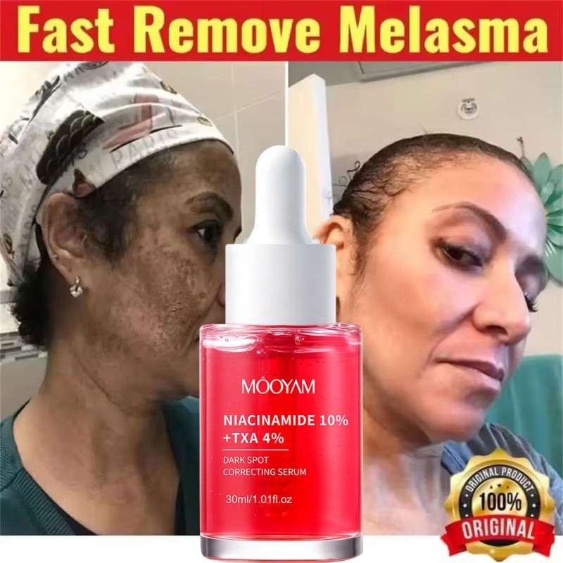 Private Label NIACINAMIDE 10%+TXA 4% Dark Spot Correcting Serum for Effective Fade Melanin