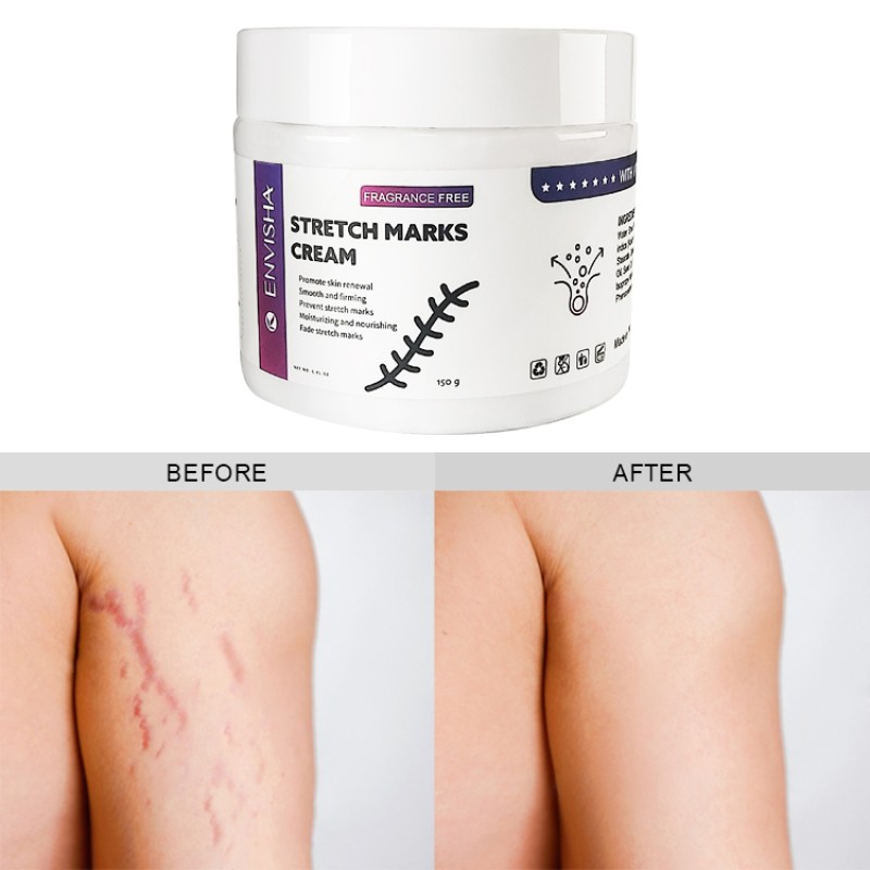 Massage Oil Manufacturer - Private Label Aromatherapy Calming Soothing Lavender Massage Oil