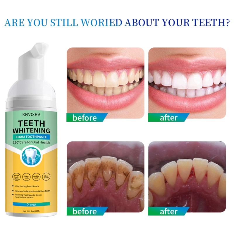 Tooth Mousse Manufacturer - OEM ODM Vegan Mint Tooth Mousse Teeth Whitening Foam