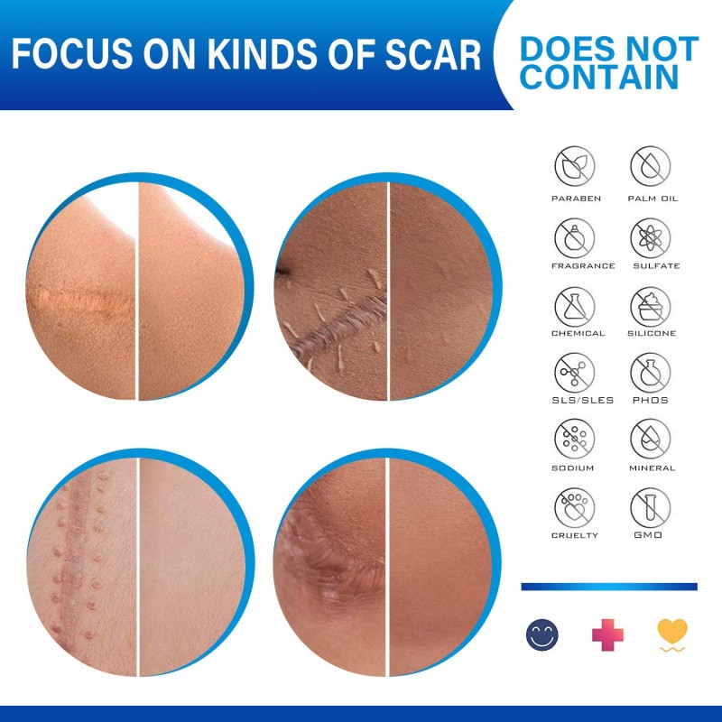 Body Perfume Oil Factory - Private Label Coconut Improve Scalp Essential Oils Massage Oil