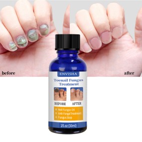 Nail Care Treatment Oil Manufacturer - Hot Sale Effectively Hand Feet Fungal Nail Repair Oil