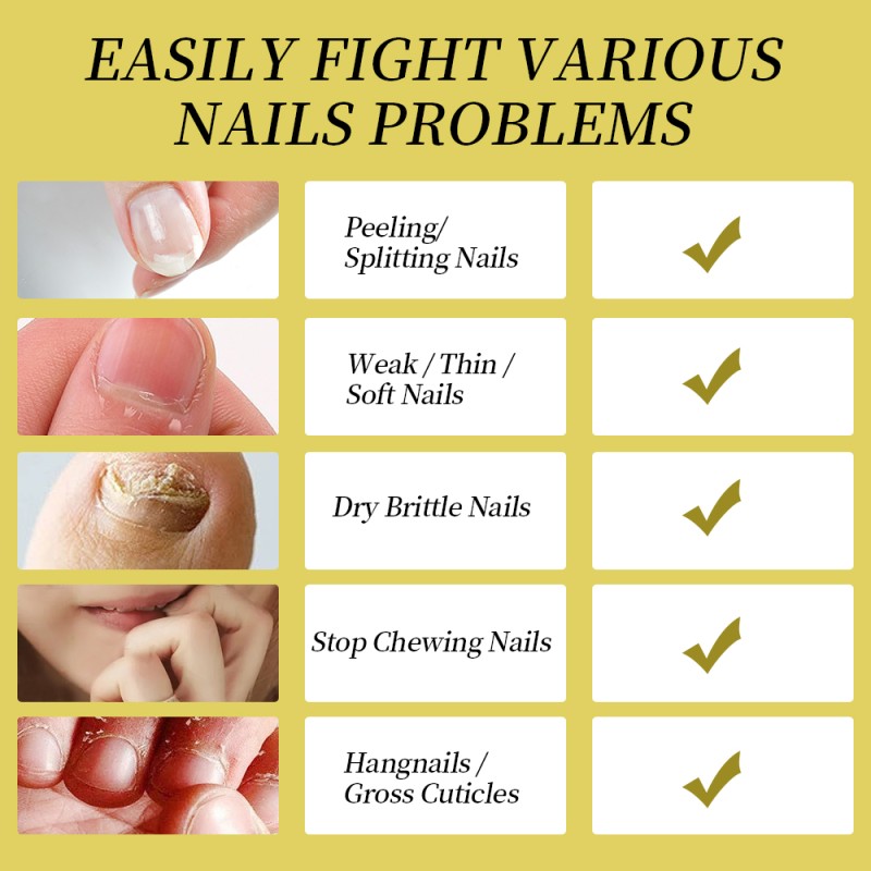 Healing Ointment Cream Manufacturer - Natural Dry Hand Feet Cracked Skin Moisturizer Cream