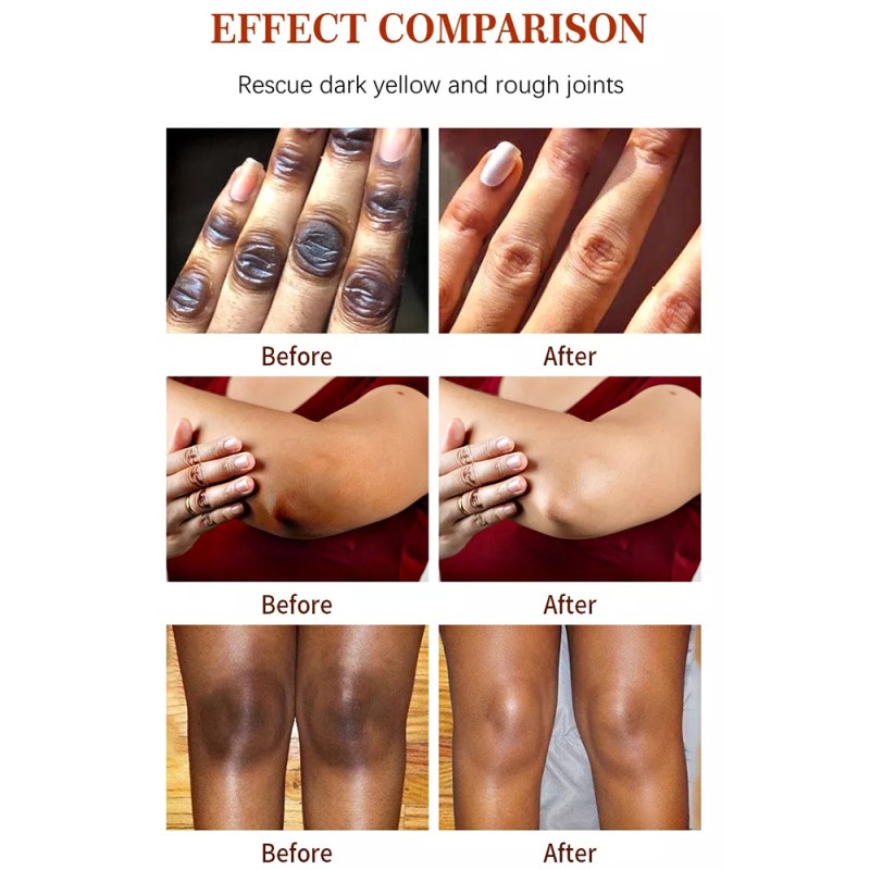 Anti Acne Face Wash Factory - Natural Salicylic Acid Foaming Cleansing Milk Whitening Mousse