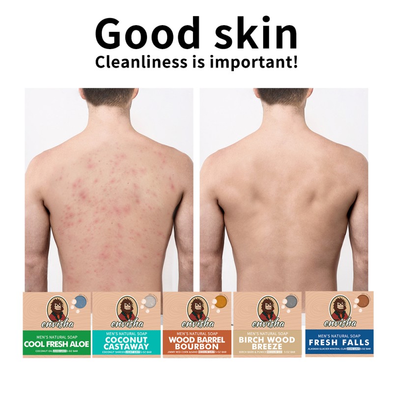 Hands Whitening Cream Factory - High Quality Dark Removal Cream for Hands Milk Almond Cream