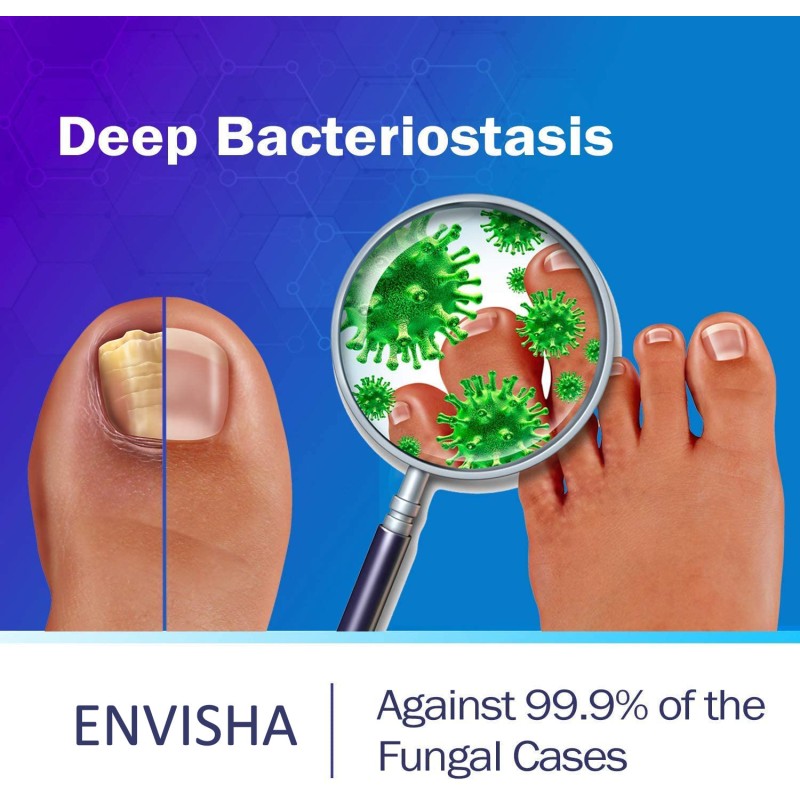 Nail Treatment Oil Factory - Custom Nail Repair Oil Anti Fungal Infection Treatment Oil