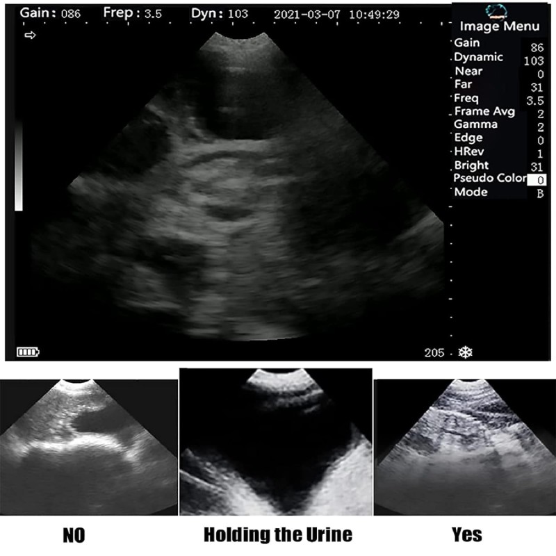 Veterinary Ultrasound Manufacturer - Mechanical Sector Pregnancy Probe