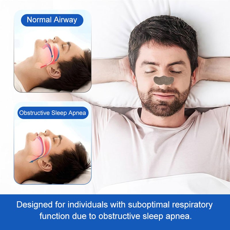 Relieve Nasal Congestion Nasal Stick Products Natural Herb Wormwood Ventilation Nasal Patch Lmprove Sleep Nasal Strips