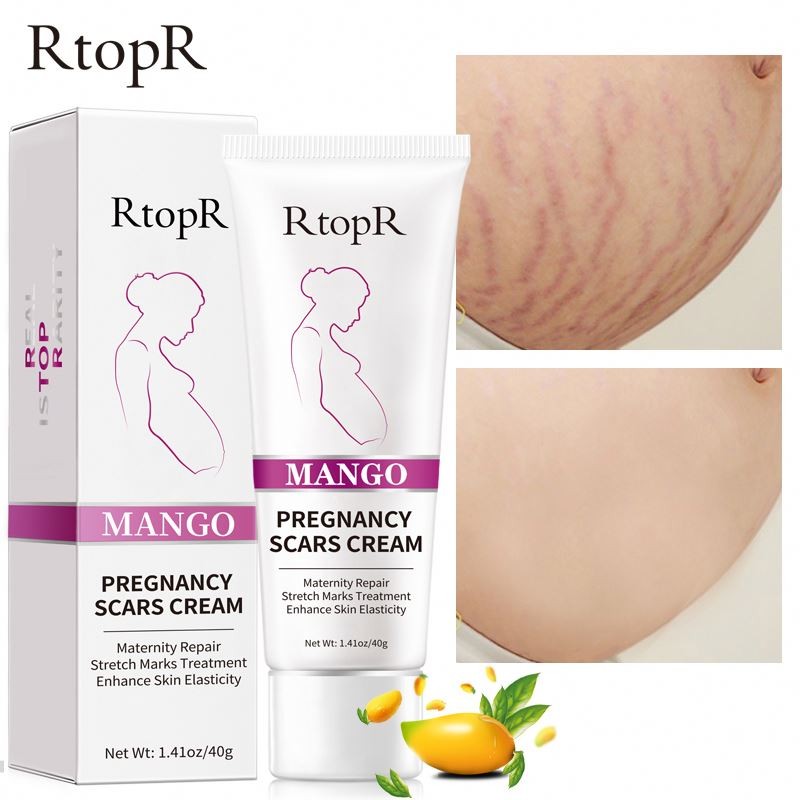 RtopR Mango Remove Pregnancy Scars Cream Repair Anti-Aging Anti Winkles Firming Body Creams