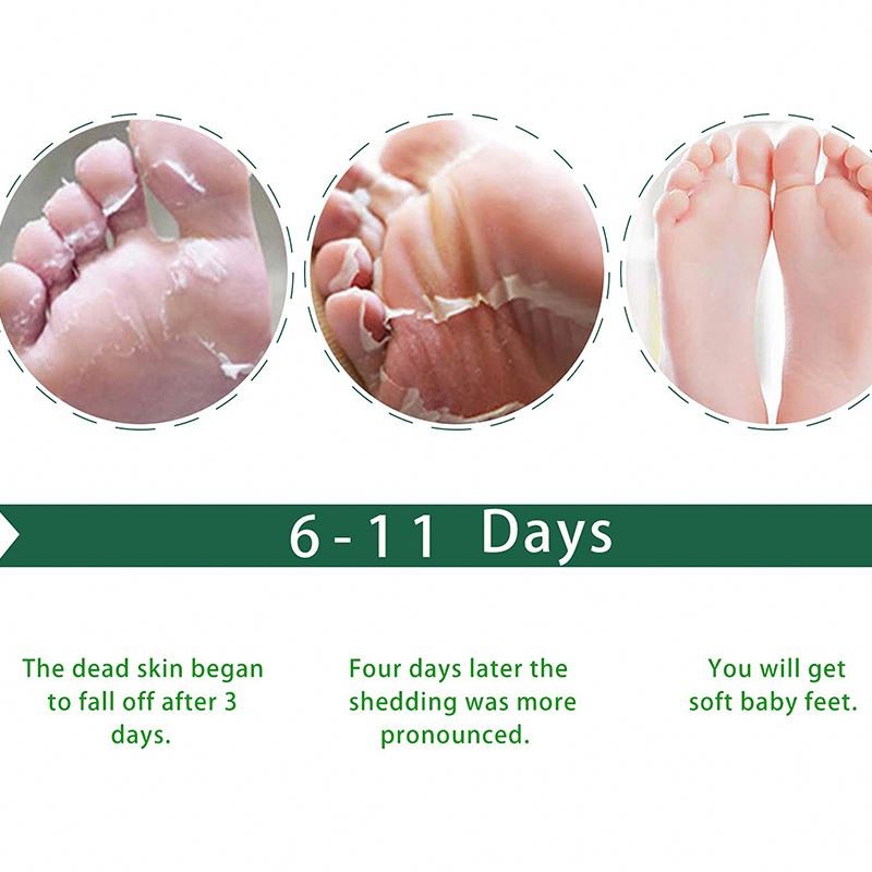 factory Hot selling Wholesale Exfoliating Peeling plastic Foot booties