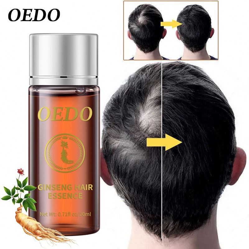 Oem OEDO Ginseng Prevent Loss Essential Oil Hair Growth Black and Shines Repair Hair-root Moist Nourishing Serum