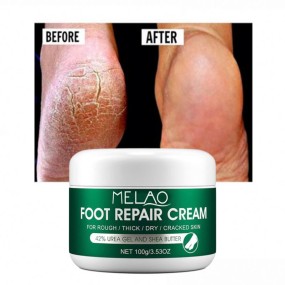 Oem Anti Fungal Scrub Exfoliation Dead Skin Removal Peeling Moisturizing Foot Care Repair Cream for Cracked Heels