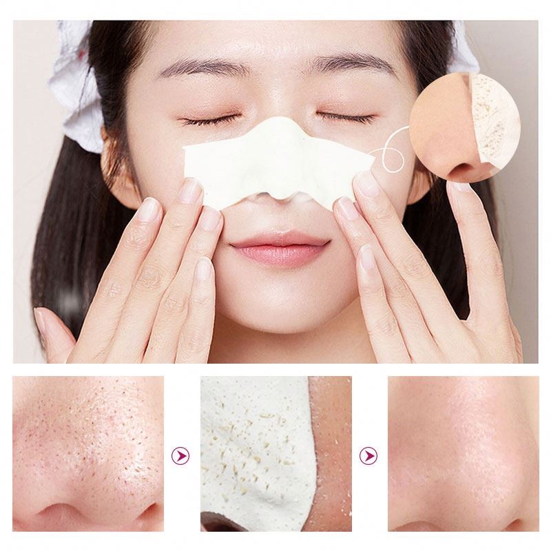 New Oem RtopR Blackhead Remover Face Nose Pore Strip Black Peeling Acne Treatment Deep Cleansing Mask Oil Control Skin Care