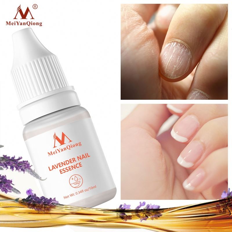 Oem Anti Infection Strong Treating Fungal Infections Nail Treatment Lavender Serum Oil for Nails and Cuticles