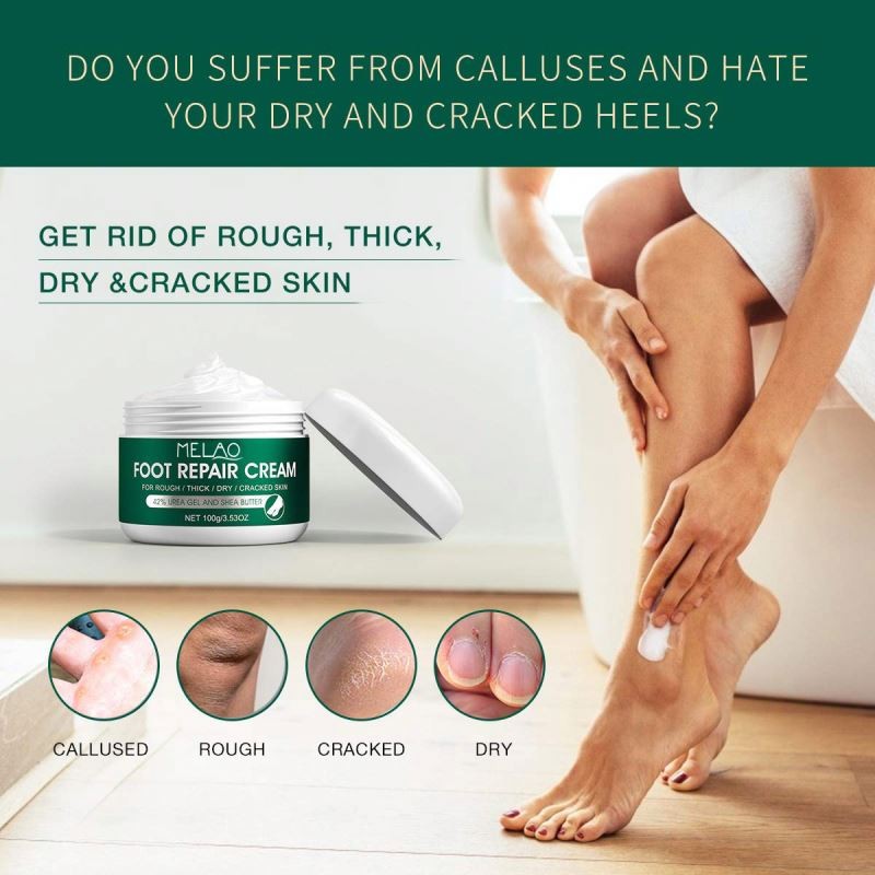 Oem Anti Fungal Scrub Exfoliation Dead Skin Removal Peeling Moisturizing Foot Care Repair Cream for Cracked Heels